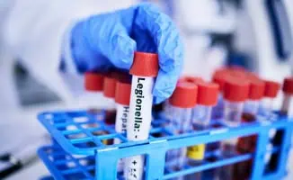 A person wearing blue gloves holding a sample of Legionella. Following a Legionella Risk Assessment