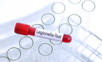 A red legionella testing tube being used as part of a Legionella Risk Assessment on commercial properties.