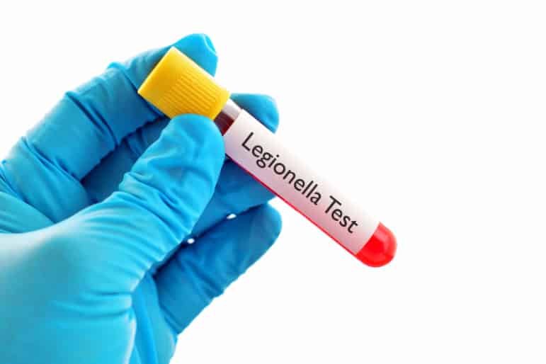 Legionella Risk Assessment Leicester