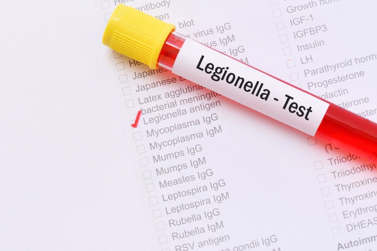 Leicester Legionella Risk Assessment