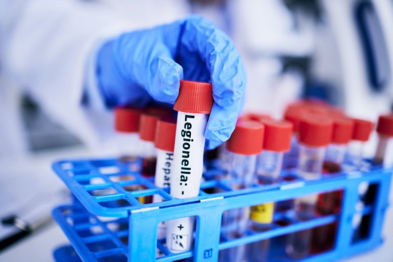 Legionella Risk Assessment in Nottingham