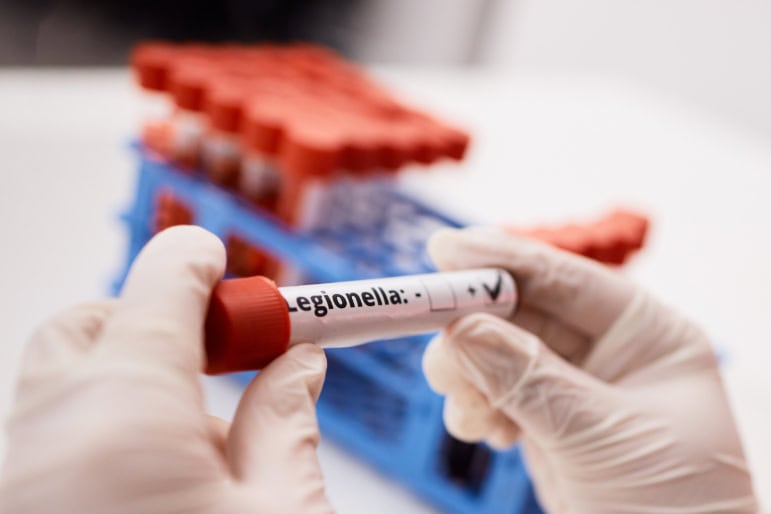 Legionella Testing Nottingham
